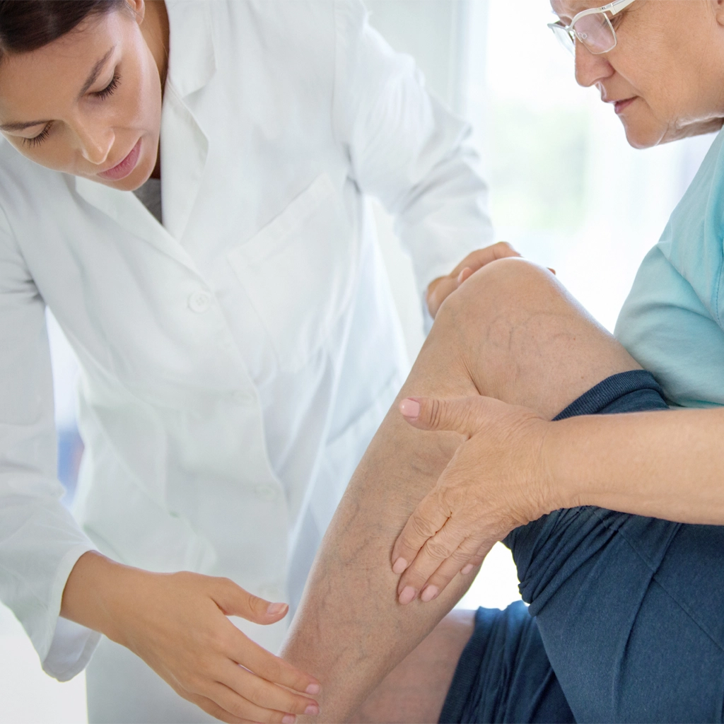 Sclerotherapy