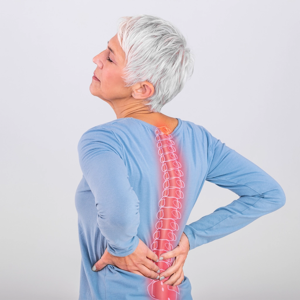 Vertebral Augmentation