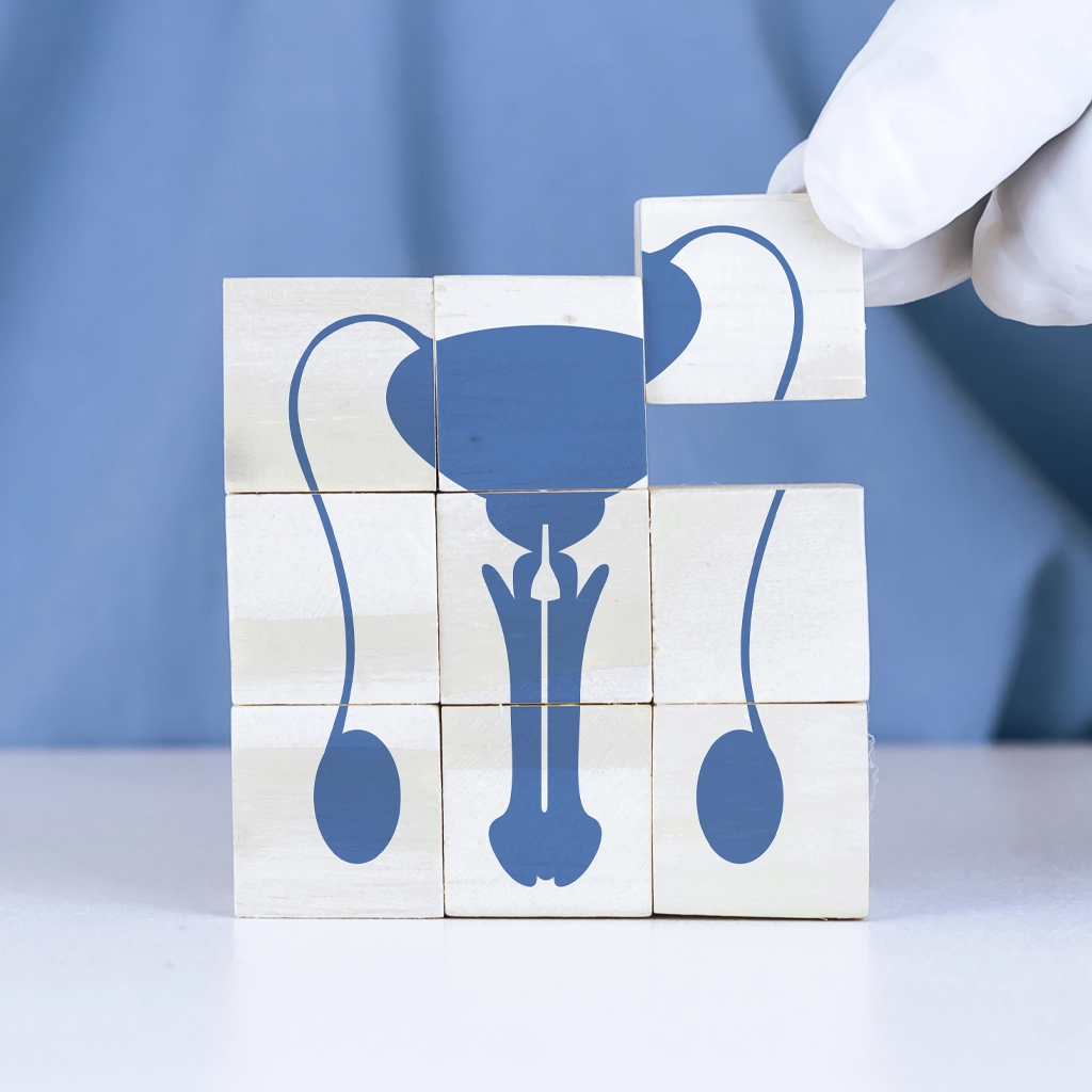 Varicocele Embolization