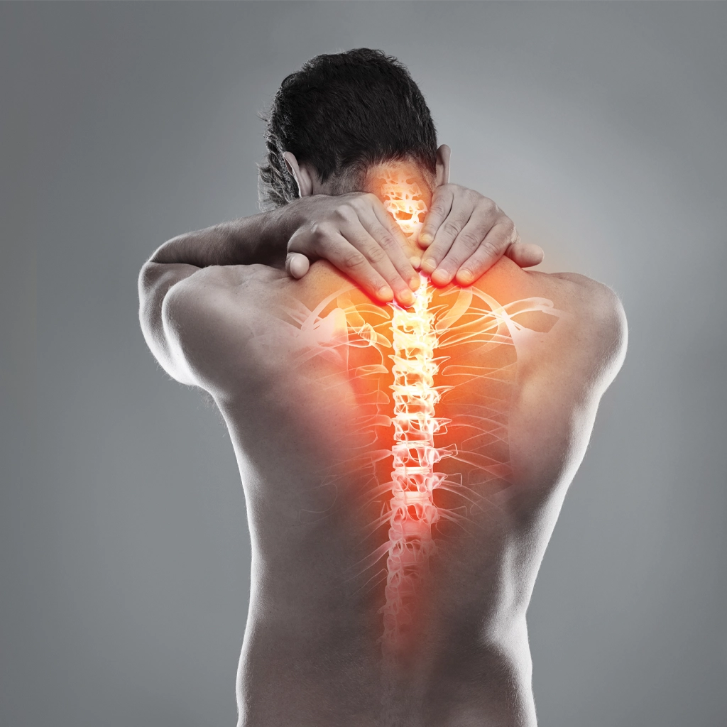 Vertebral Augmentation